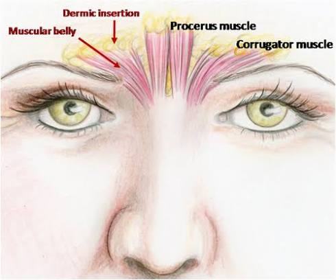 Understanding Botox Injecting Depths: Avoiding Brow Ptosis